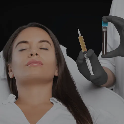 PRF EZ-Gel platelet rich fibrin regenerative treatment face San Diego SOM Aesthetics