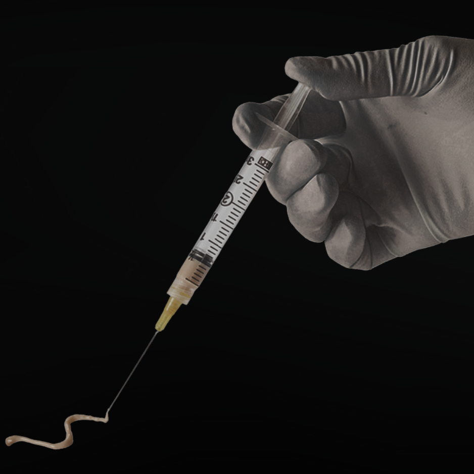 Renuva injectable fat transfer volume restoration face hands San Diego SOM Aesthetics