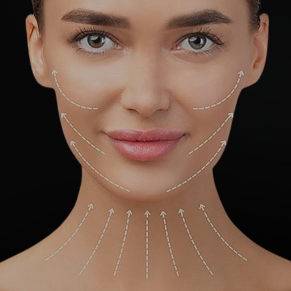 Liquid facelift full face rejuvenation filler San Diego SOM Aesthetics Dr Khalifian