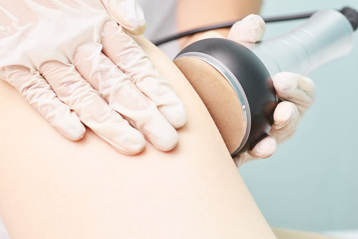 How Does Cavitation Treatment Compare to Other Body Contouring Methods?	