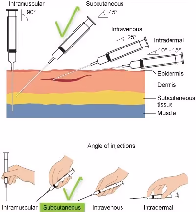 Medical diagram comparing injection techniques and needle angles for intramuscular, subcutaneous, intravenous, and intradermal injections, highlighting the correct angle for subcutaneous administration.