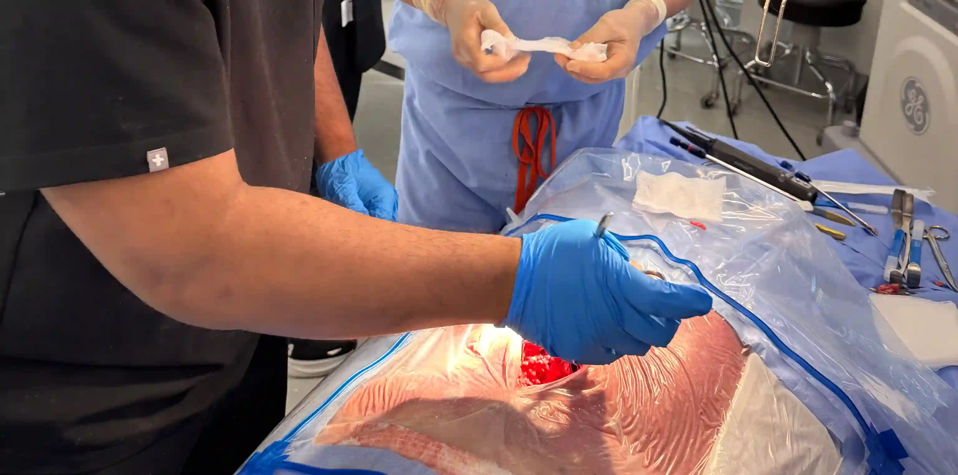 Medical professionals performing surgery on a patient covered in sterile drapes with exposed incision.