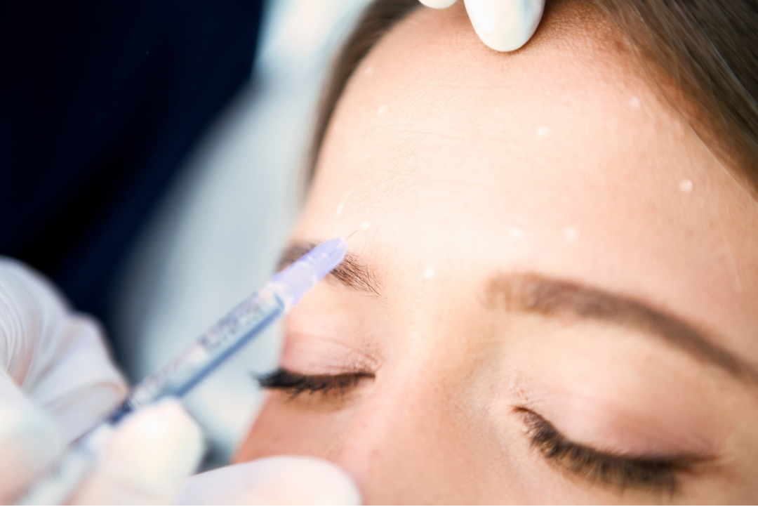 Botox and Dysport for Wrinkle Reduction