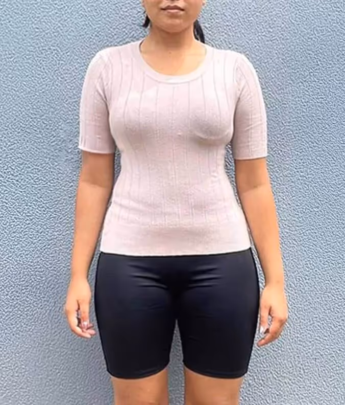 After Semaglutide