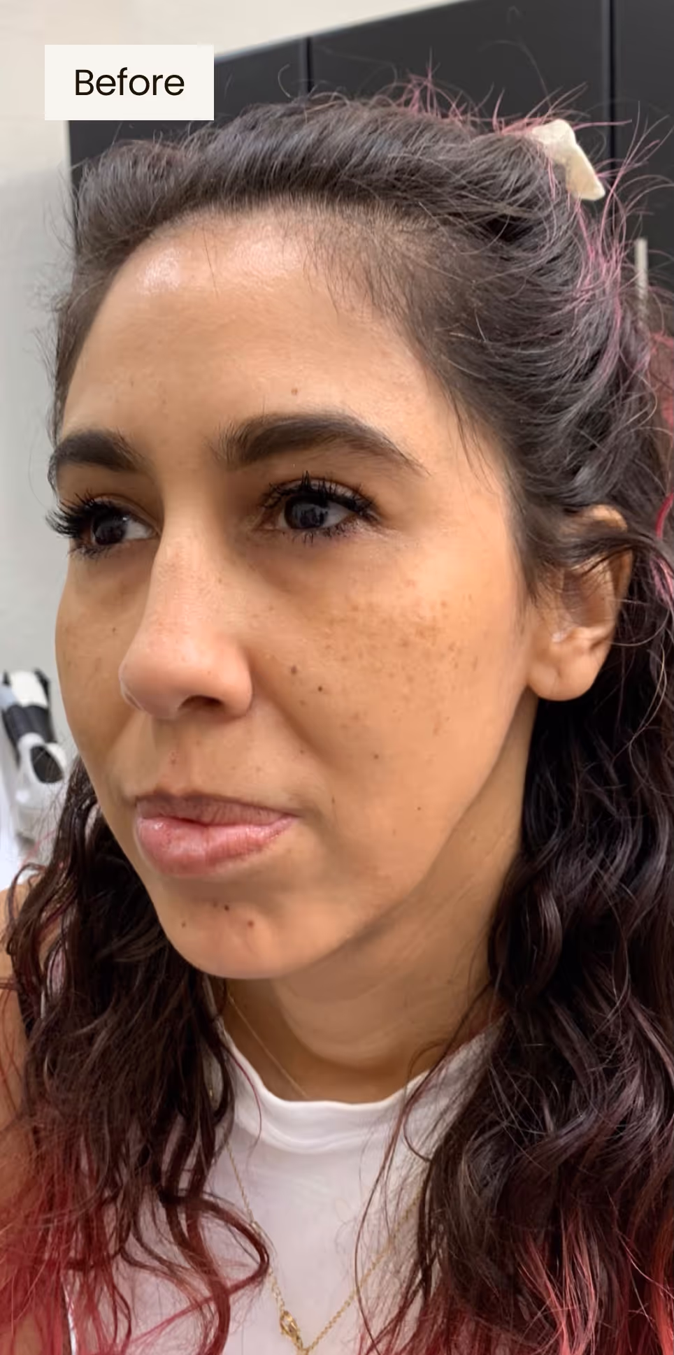 before procedure image