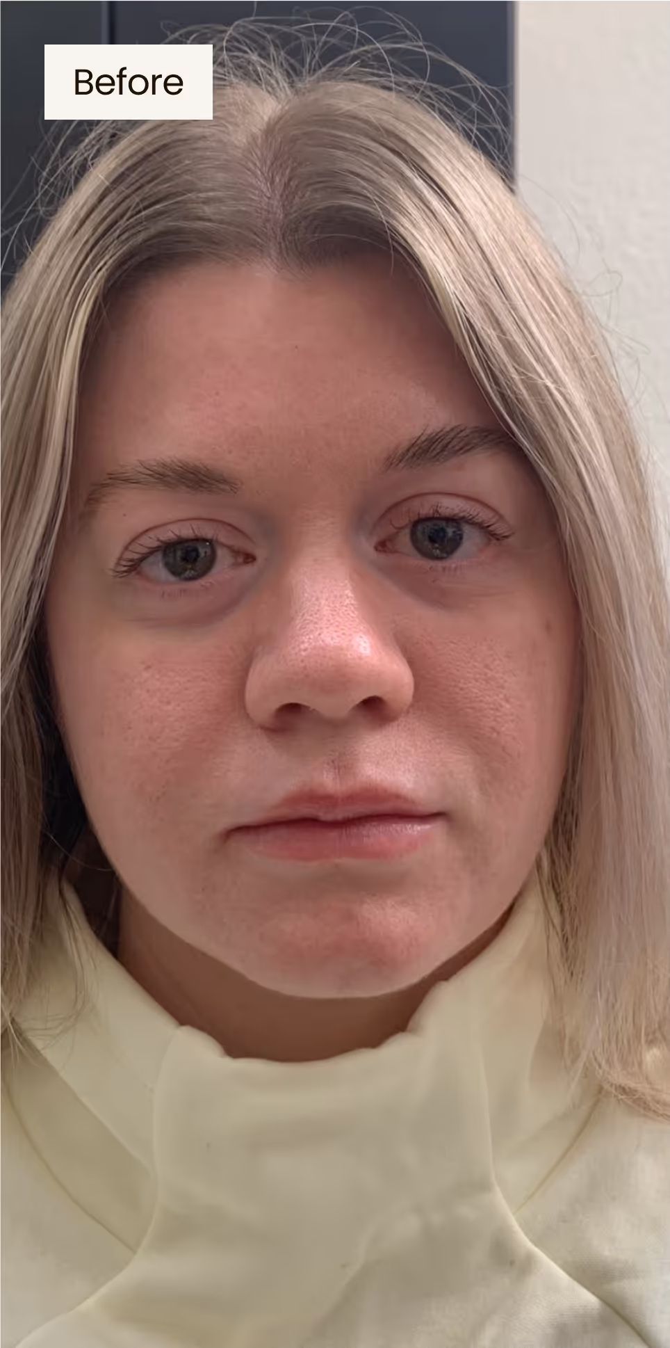 before procedure image