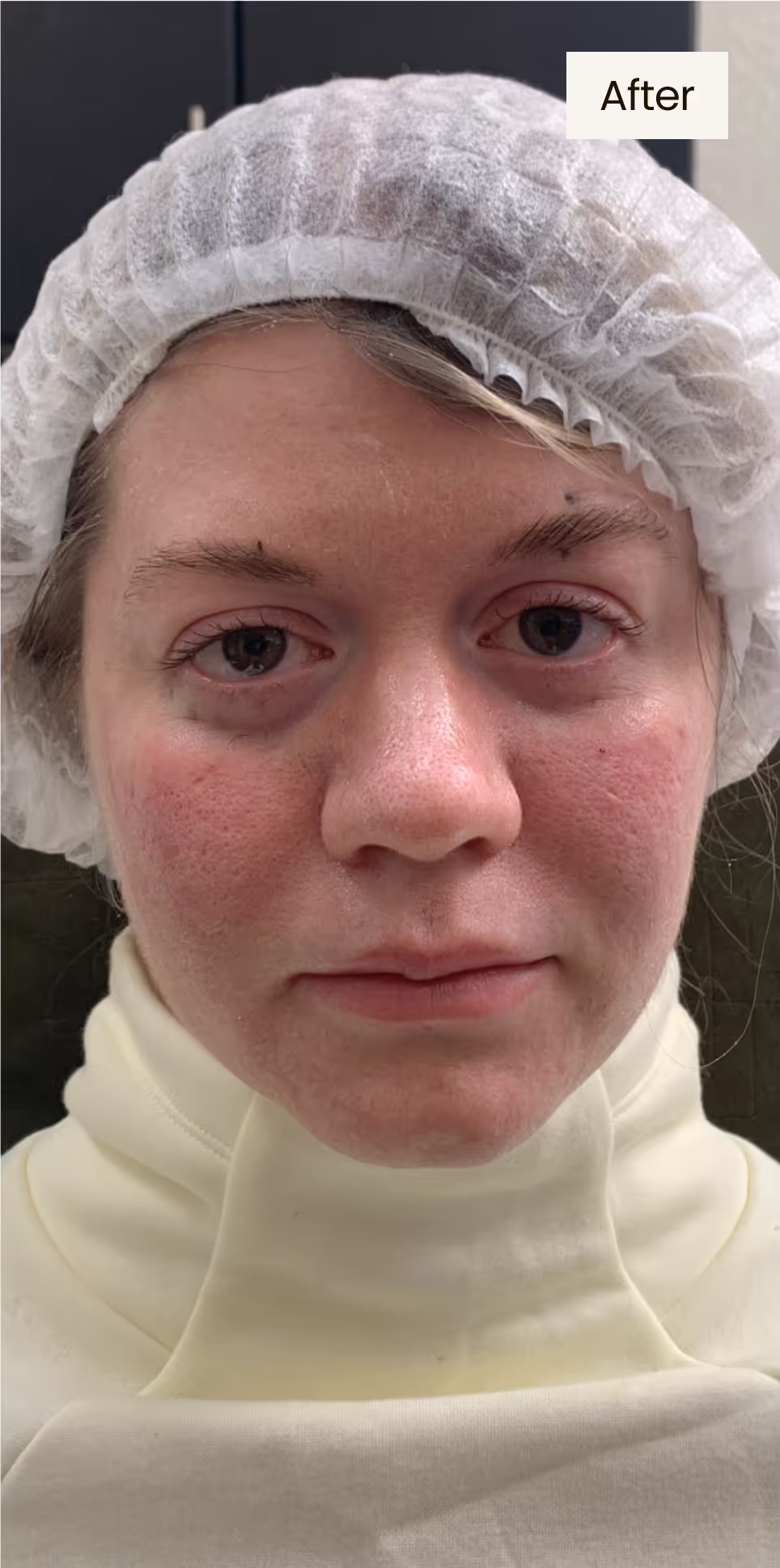 After procedure image