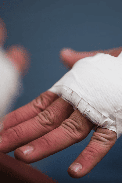 dog bite injury