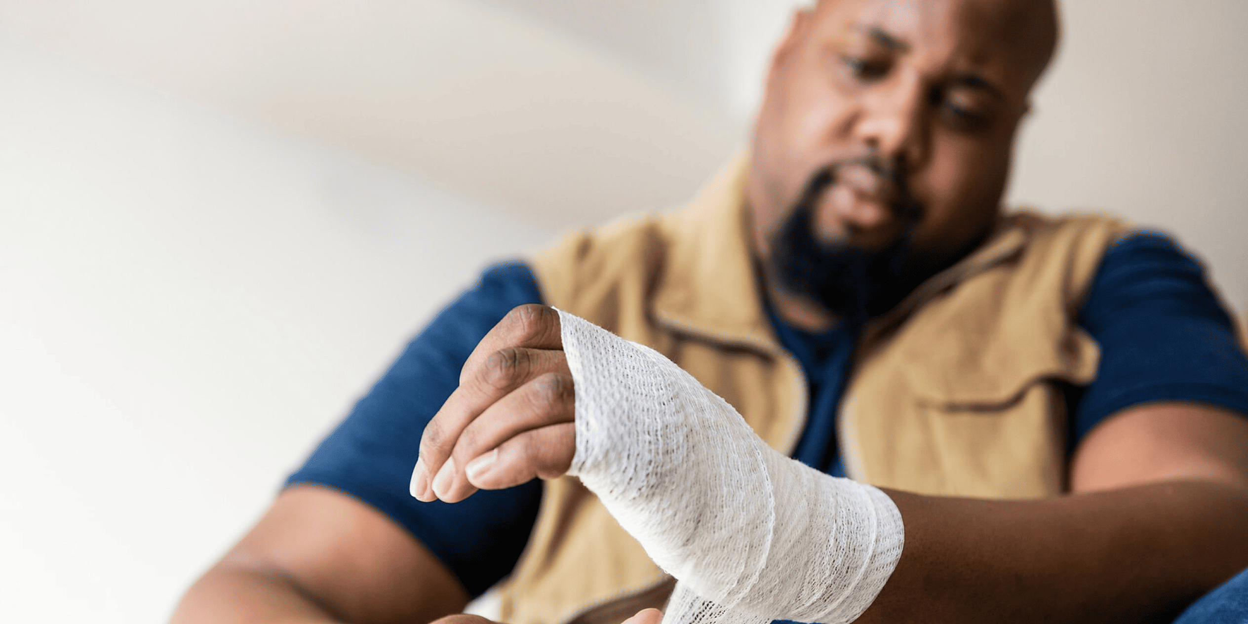 man with burn injury