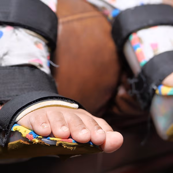 Close-up of toddler's foot in a colorful orthopedic brace with black straps.