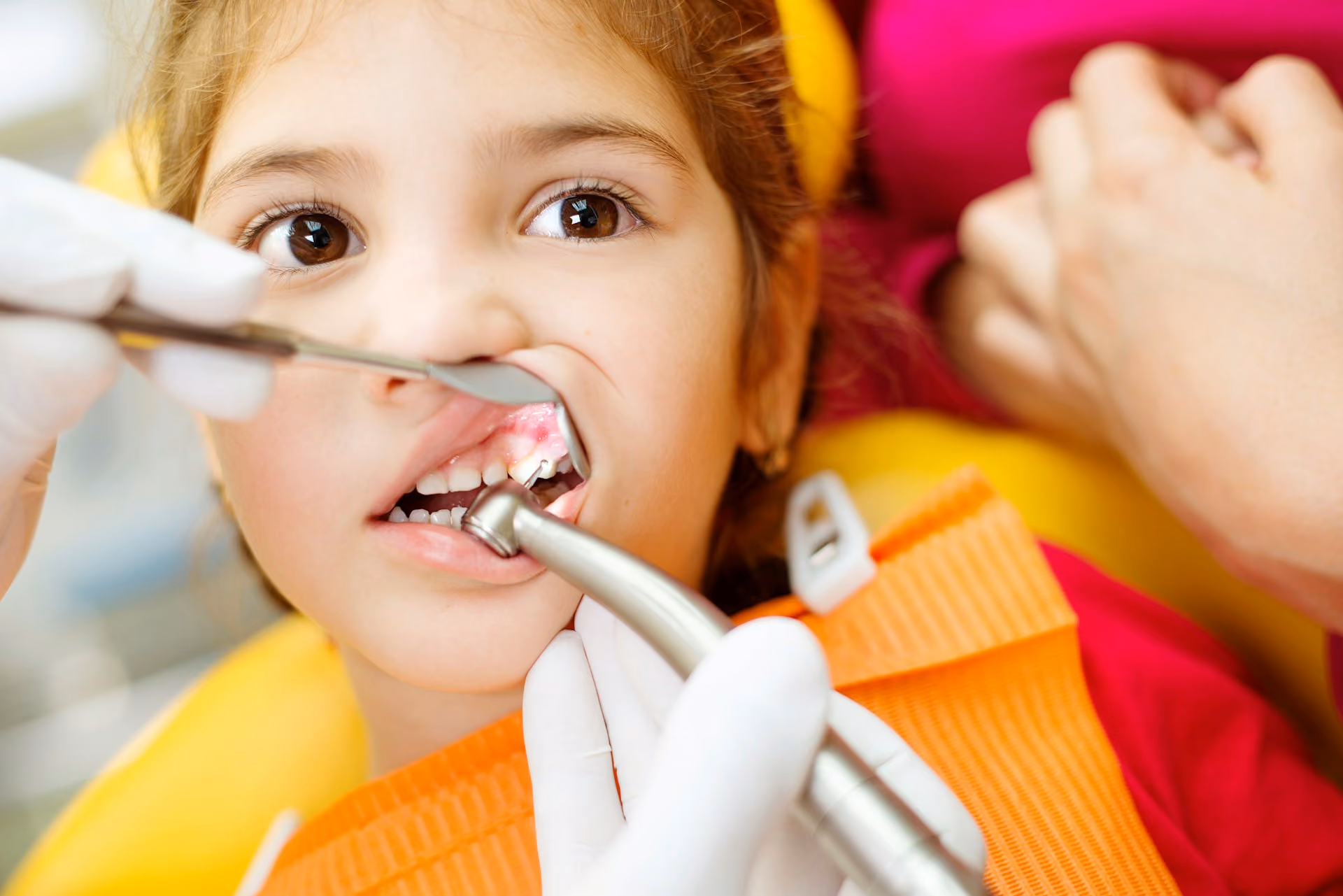 Dental Care Approaches for Children With Special Needs