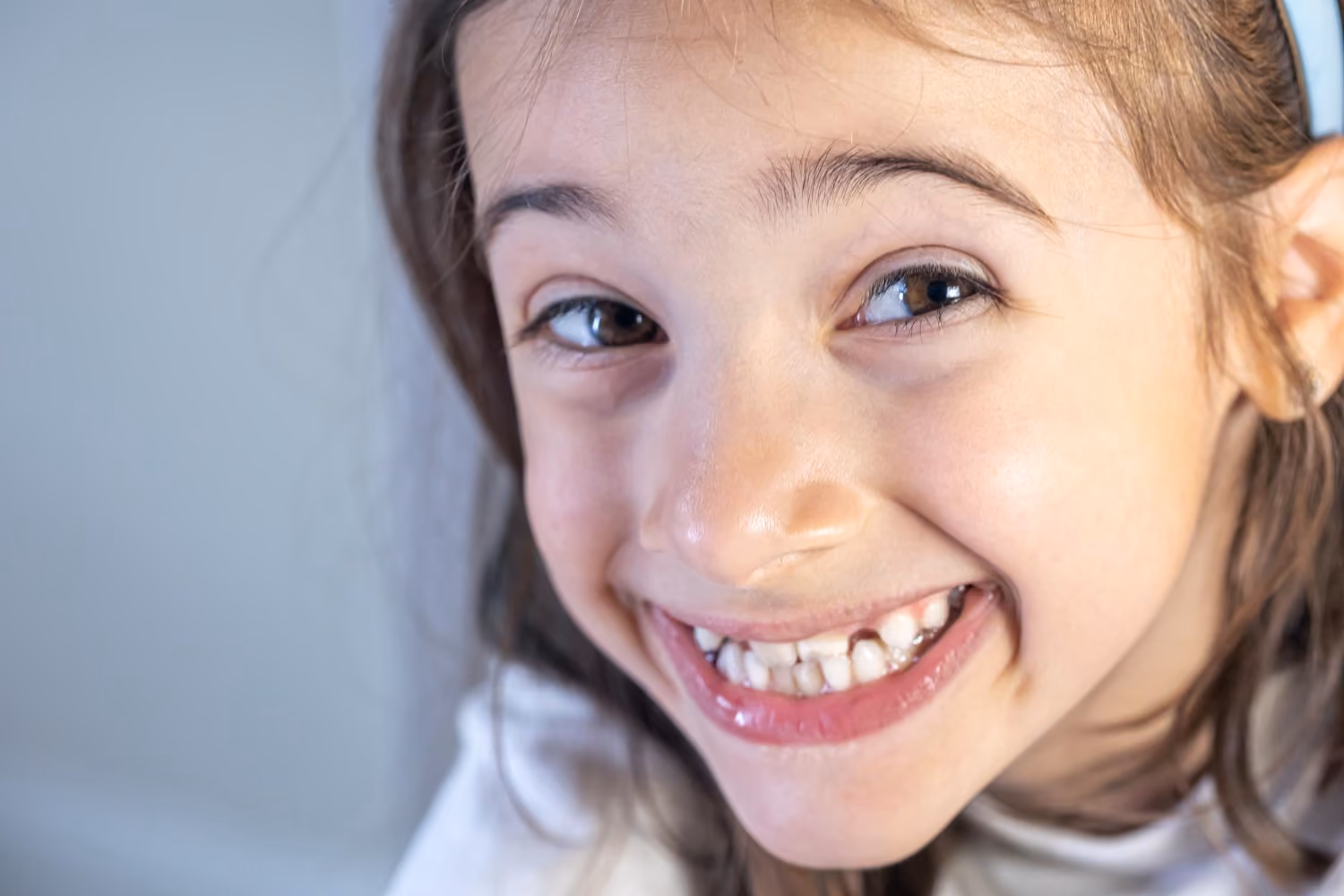White Patches on Your Child's Teeth Explained