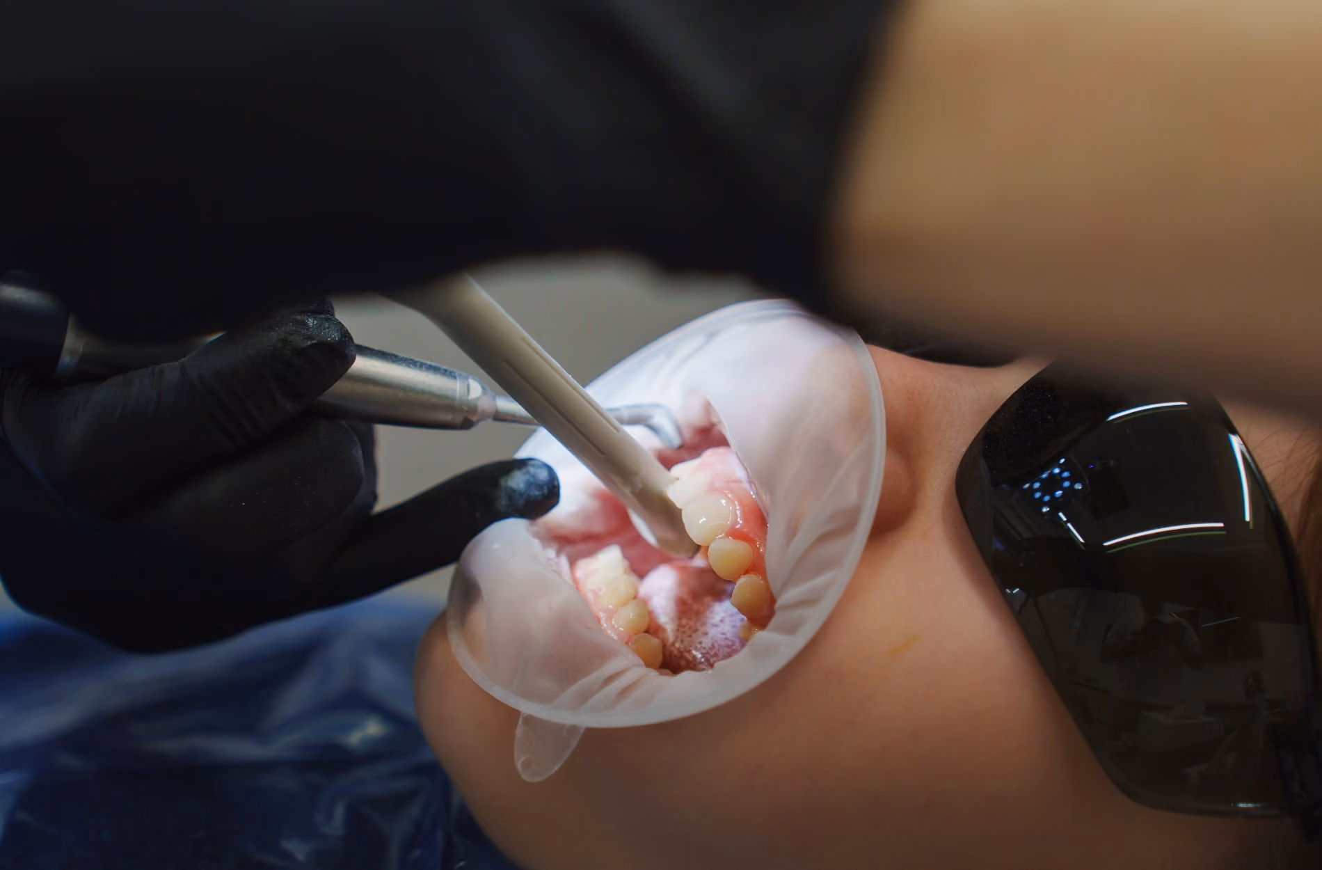 Comfortable Sedation for Children's Procedures