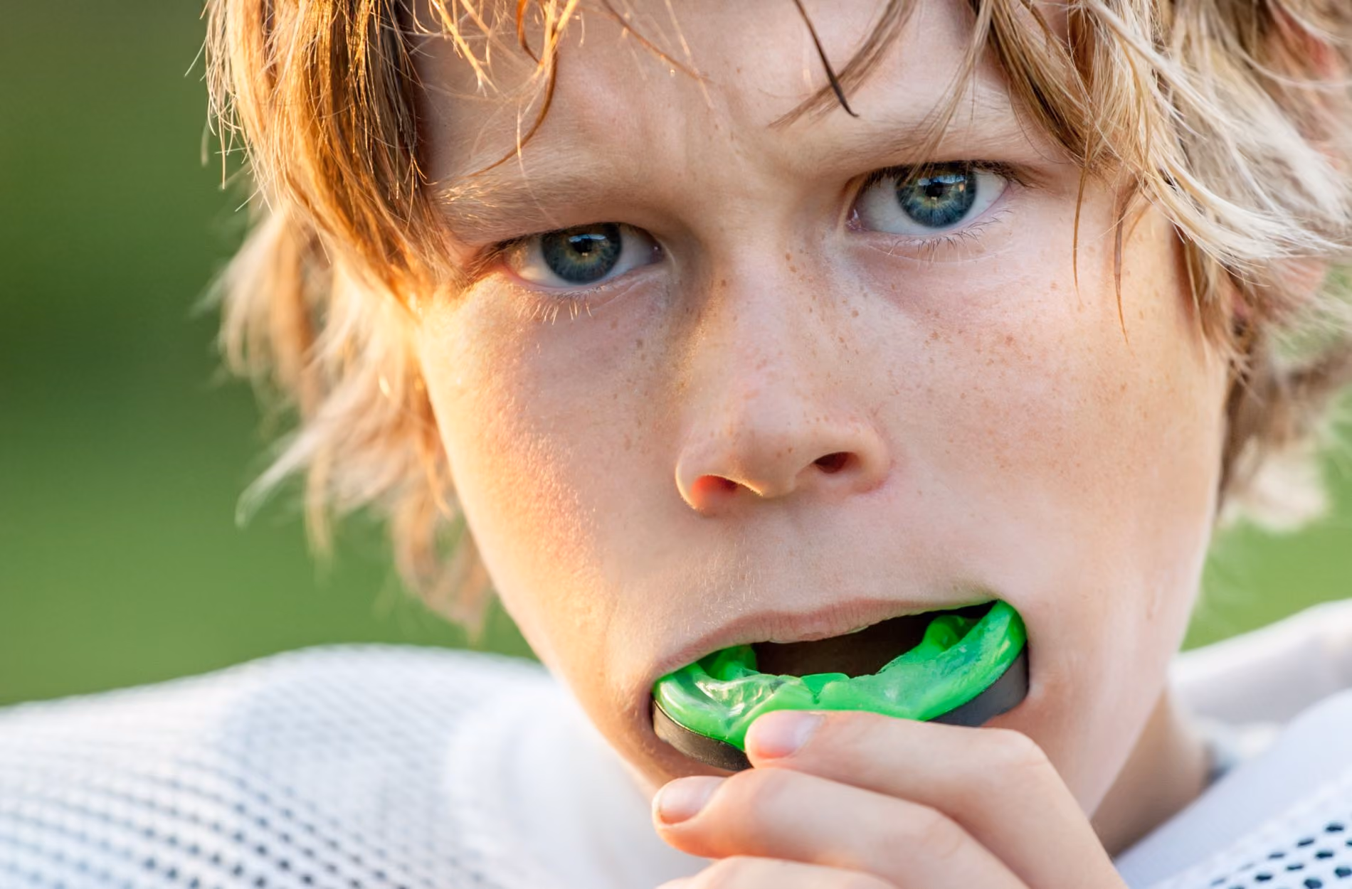 Why Kids Should Wear Mouthguards for Spring Sports