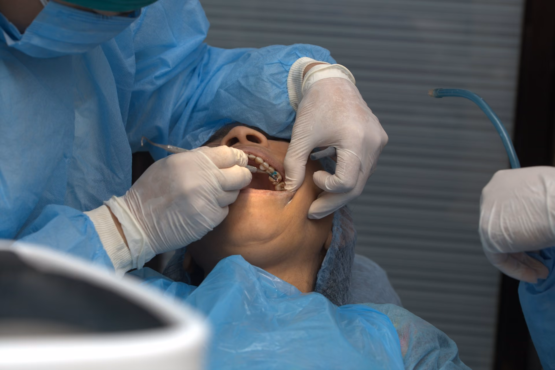 What a Fluoride Dentist Can Help Stop Before It Starts
