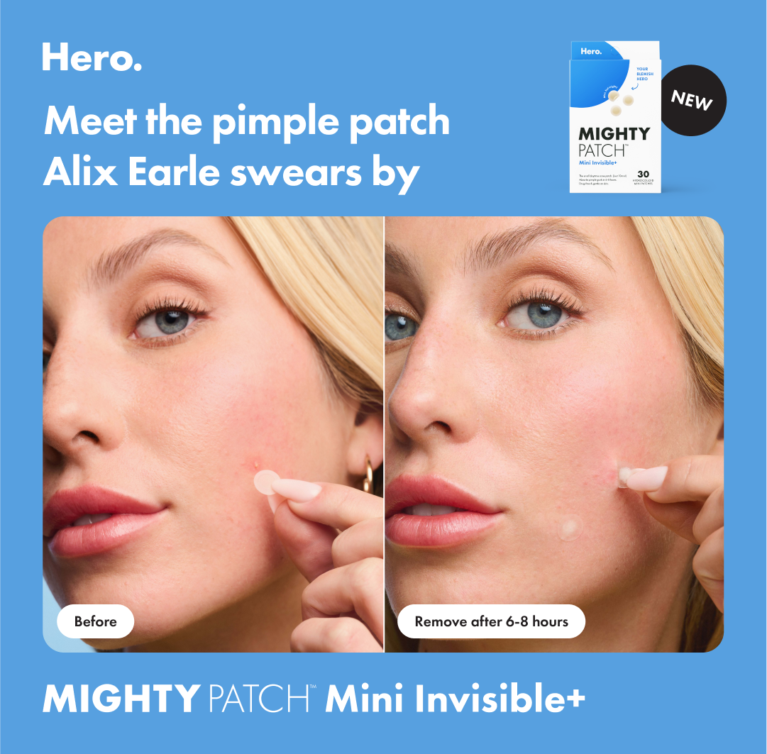 Instagram ad template: Before & after ad example