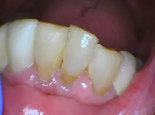 Before Image
