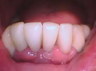 After Image