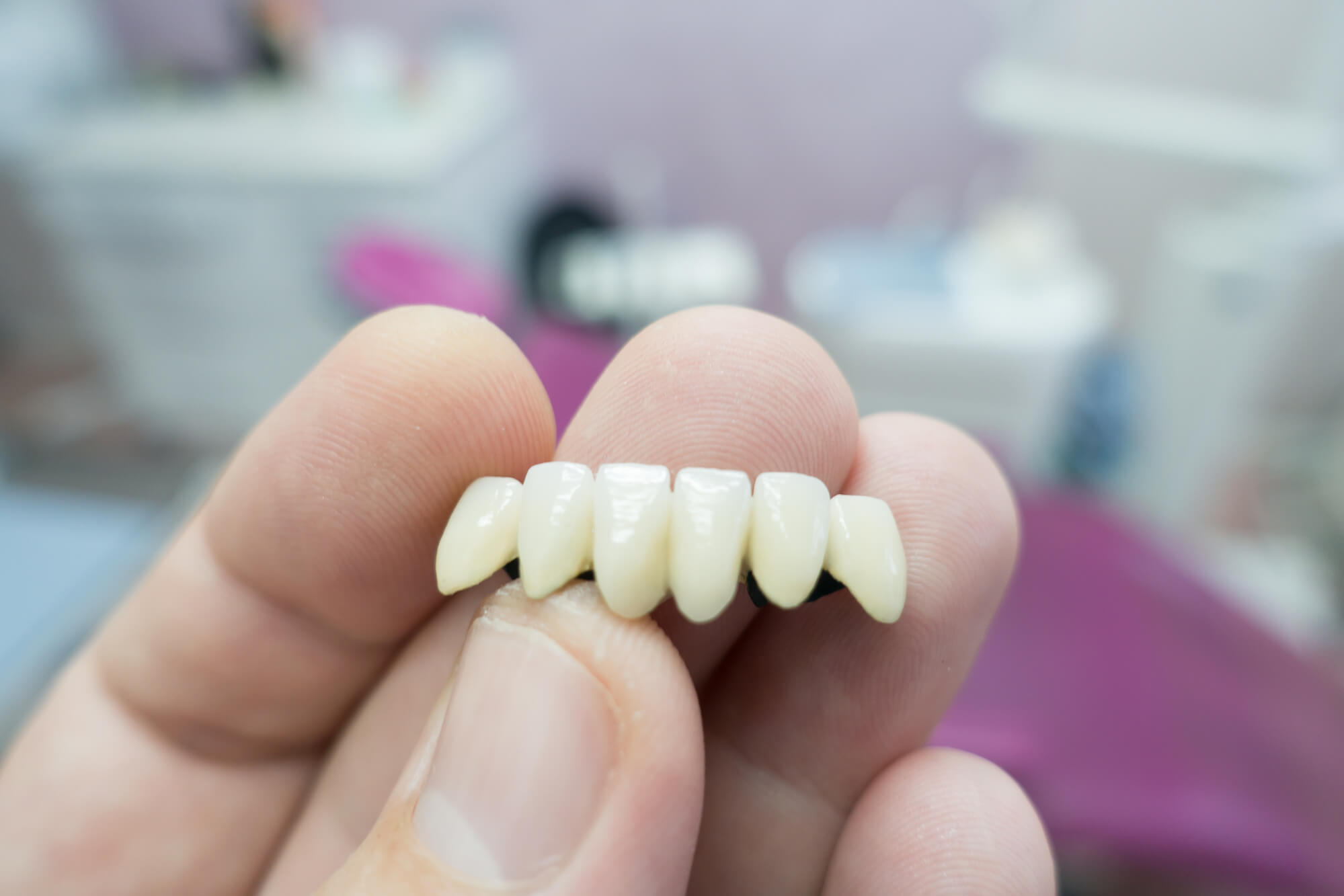 Porcelain dental crowns Summerfield FL