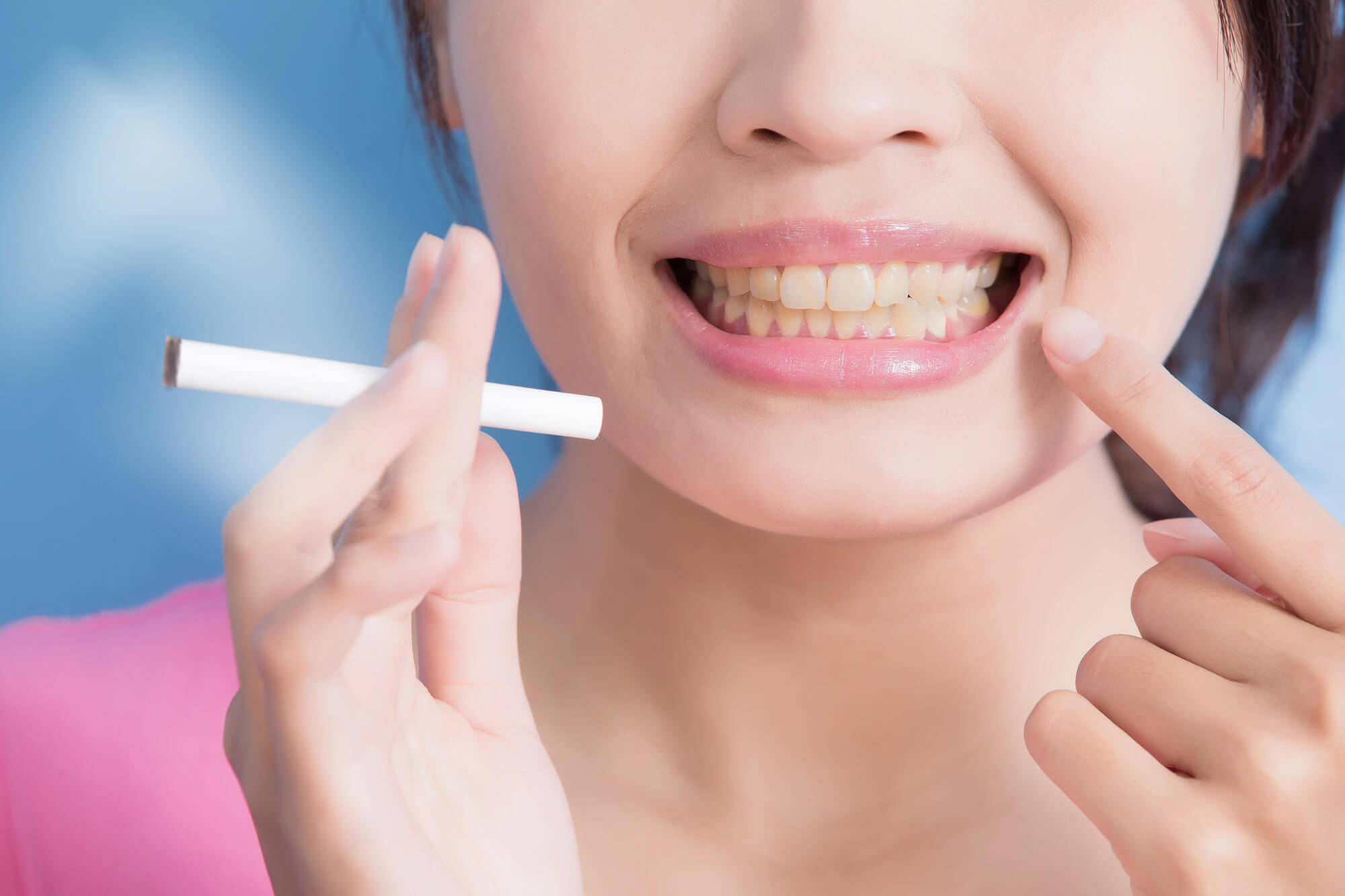smoking causes Porcelain dental crowns Summerfield FL stains
