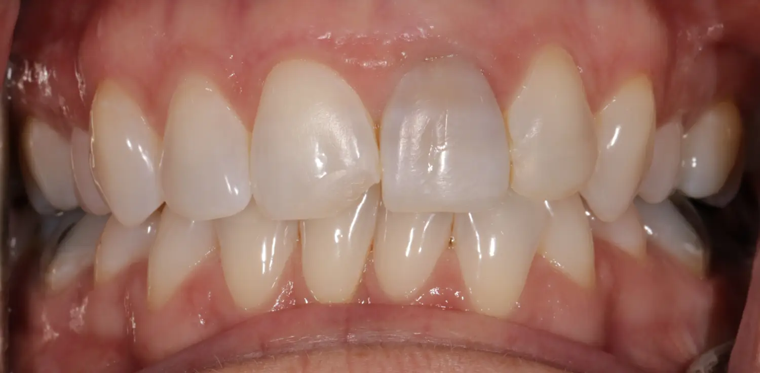 Before Image