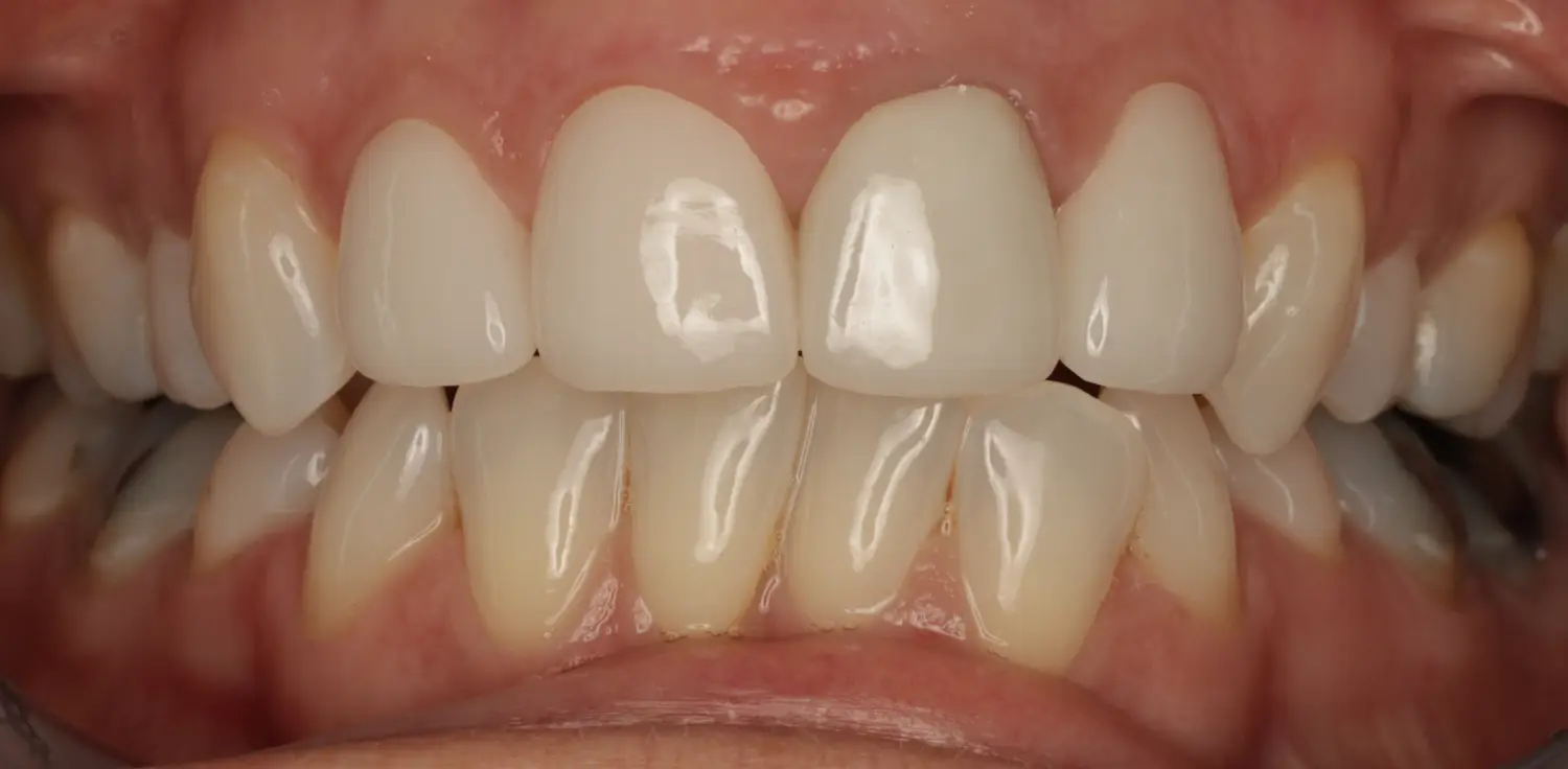 After Image