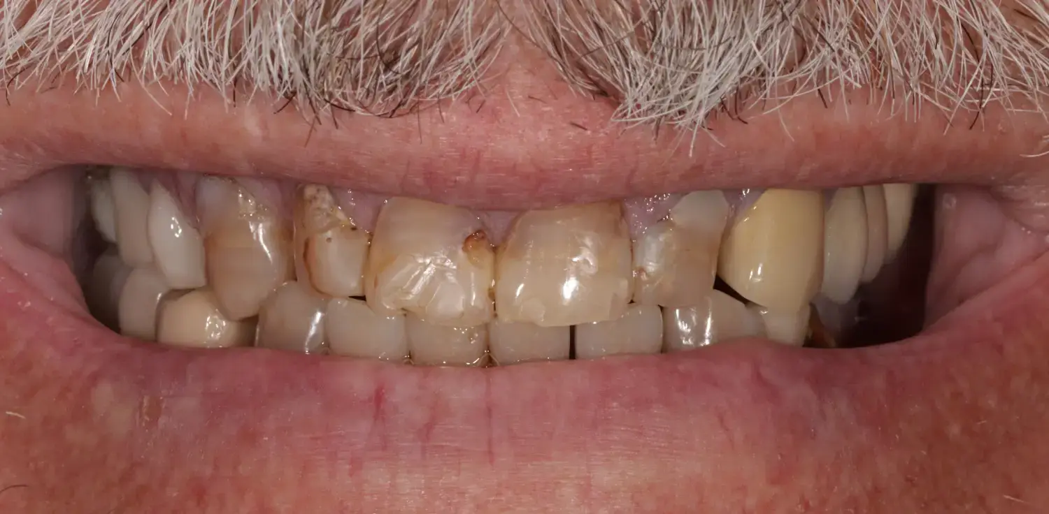 Before Image