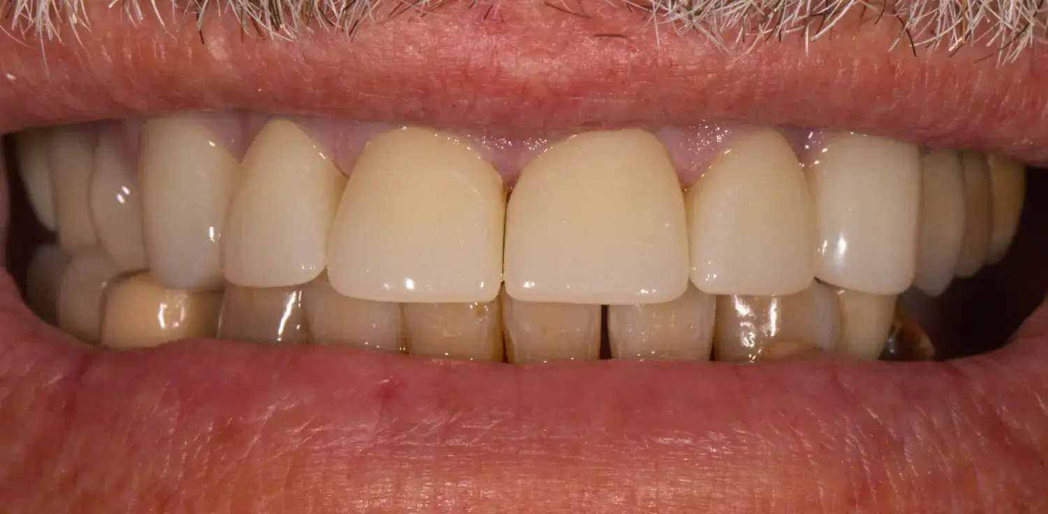 After Image