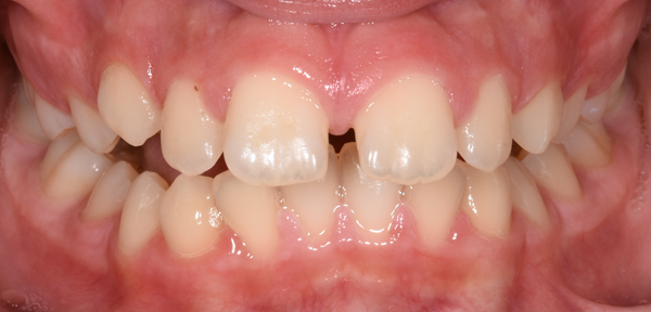 Before Image