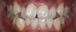 Before Image