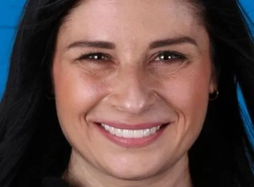 stomatologia-na-podzamczu-metamorfoza-adrianna