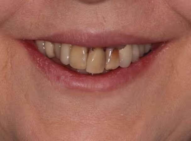 stomatologia-na-podzamczu-metamorfoza