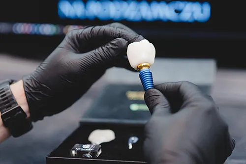 What-does-a-dental-implant-look-like