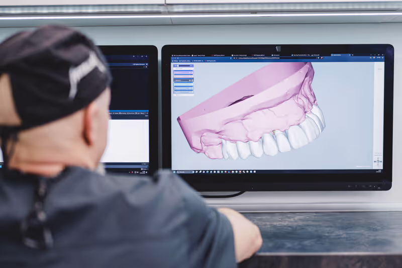 digital-smile-design-szczecin