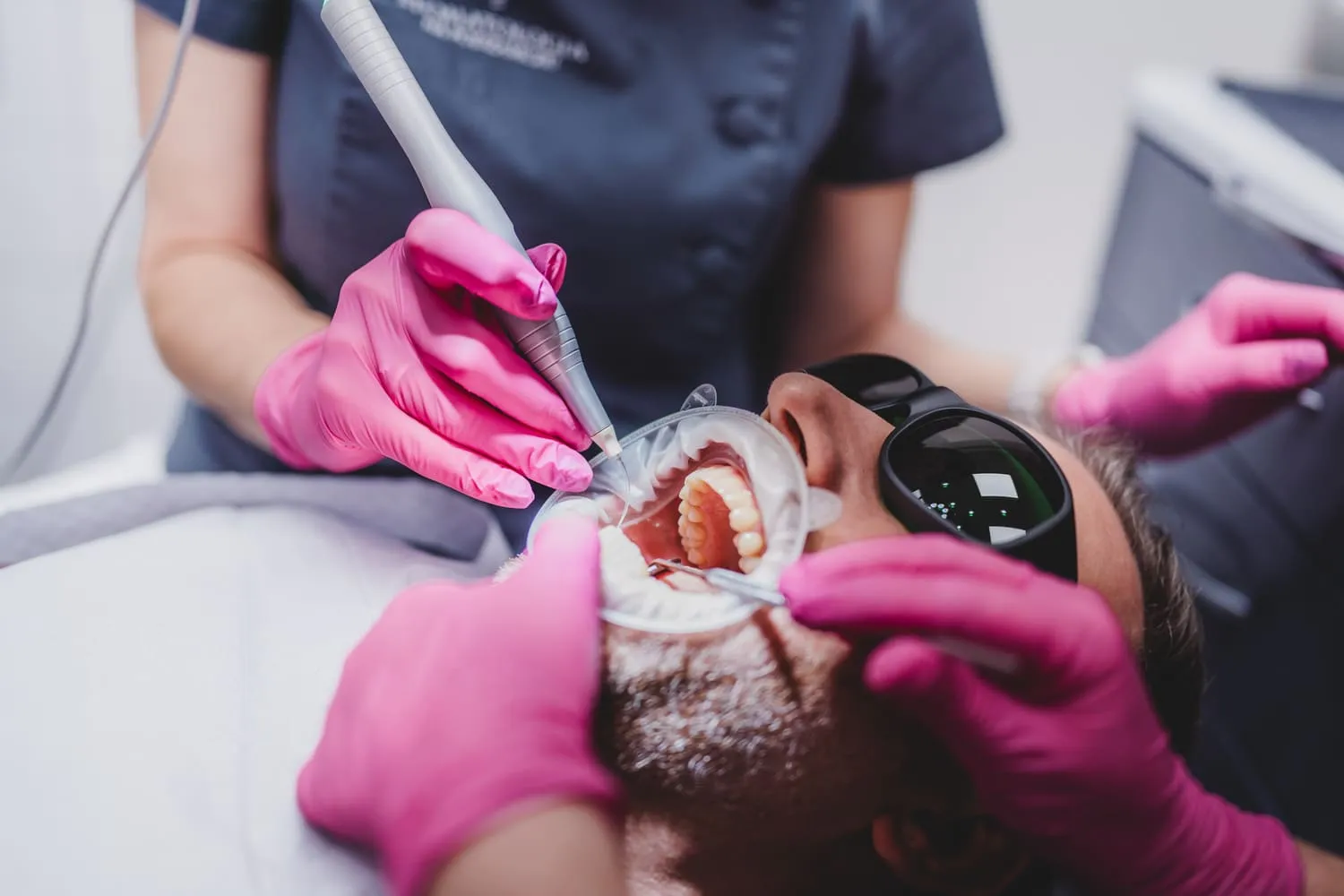 laser-gum-correction