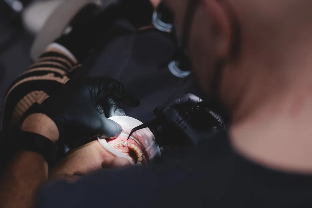 bridge-on-implants-szczecin