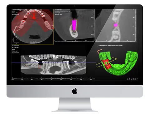 computer-navigation-dds-pro-dentistry-szczecin