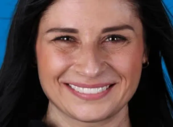 stomatologia-na-podzamczu-metamorphosis-adrianna-after