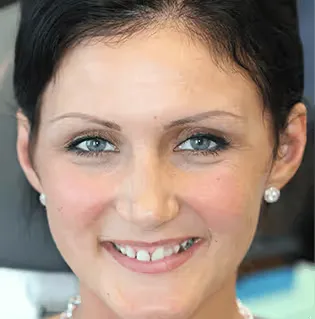 jasmina-before-transformation-snp