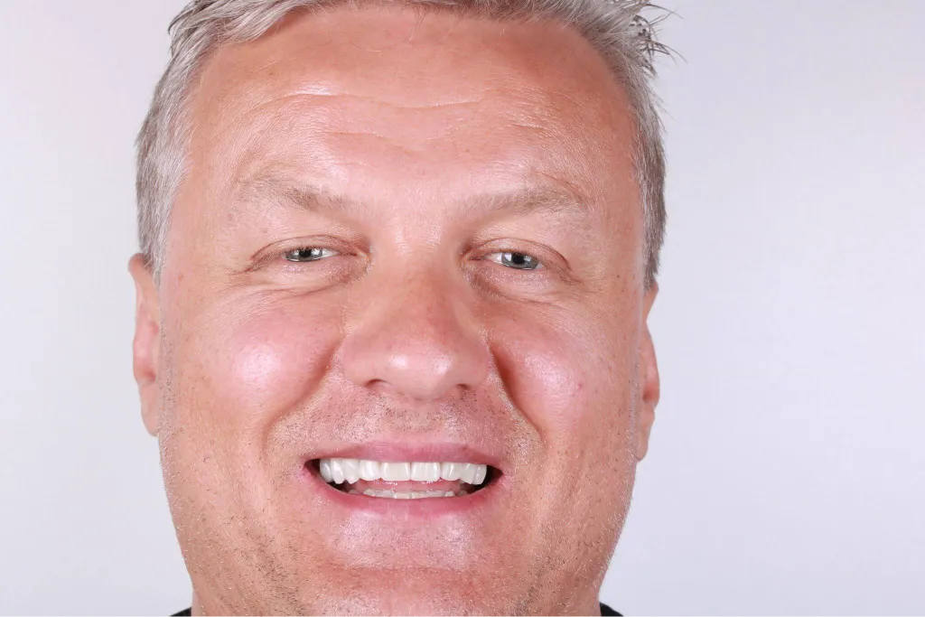 metamorphosis-henryk-stomatologia-na-podzamczu-1