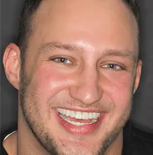 mateusz-metamorphosis-snp