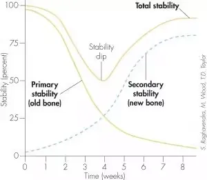 osteointegration-implants-szczecin