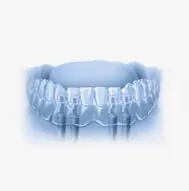 treatment-options-prosthesis-stomatologia-na-podzamczu