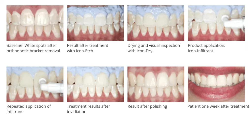 ICON-effects-stomatologia-na-podzamczu