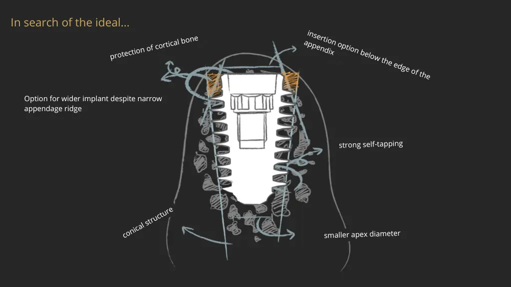 short-implants-AnyRidge