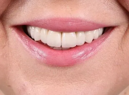 Stomatologia-na-Podzamczu-Transformation-after
