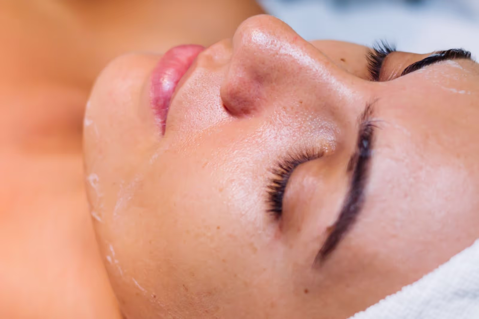 peeling phénol photo 