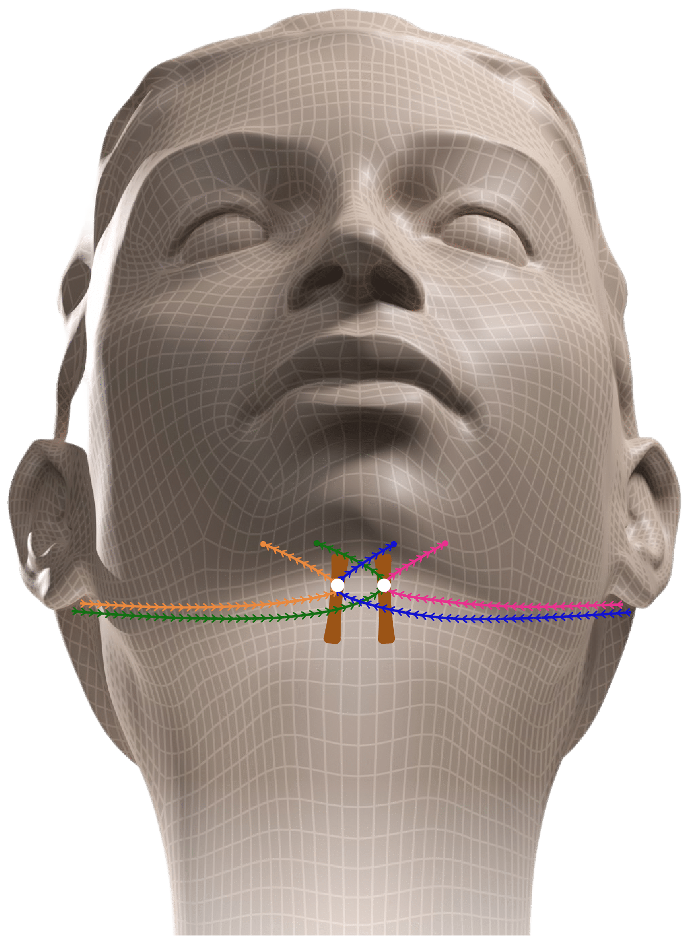 Dr. Foumenteze - Fils tenseurs