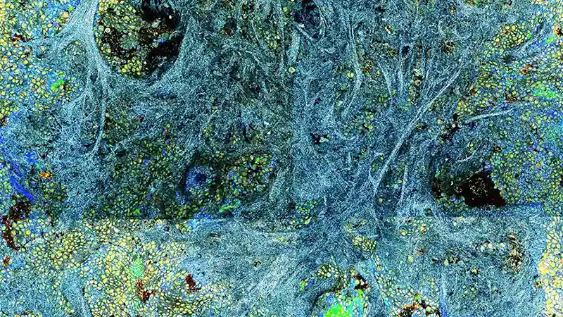 Ion biopsy analysis using CelTivity