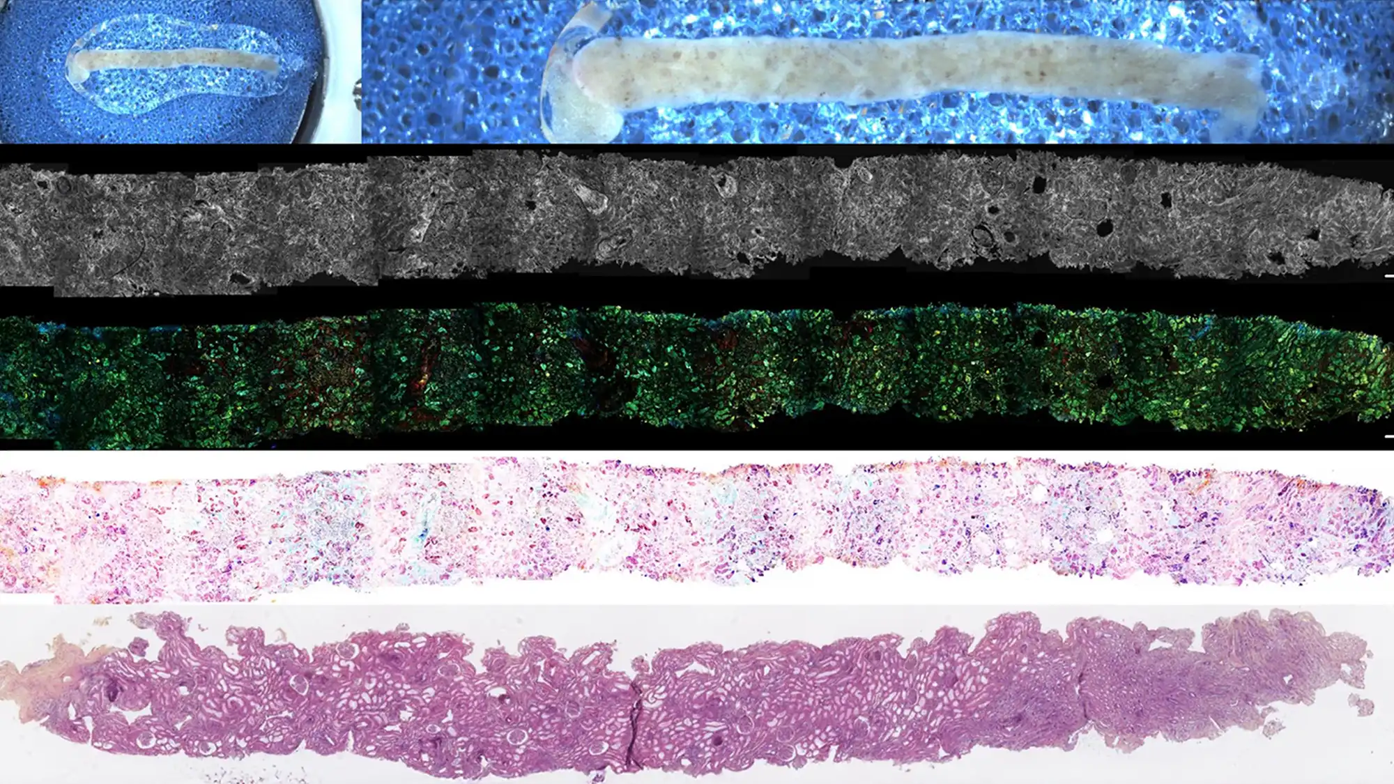Rapid On-Site Kidney Biopsy Analysis With D-FF-OCT Imaging